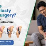 What Is Microplasty Knee Surgery A Clear Guide to Partial Knee Replacement