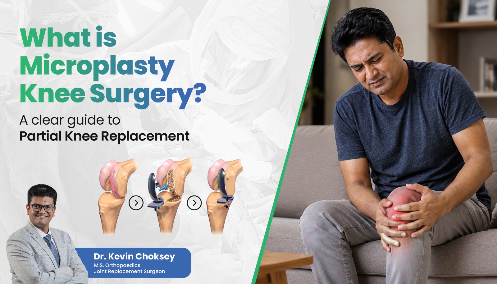 What Is Microplasty Knee Surgery A Clear Guide to Partial Knee Replacement