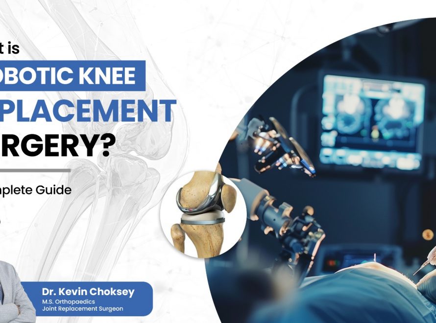 robotic-knee-replacement-surgery