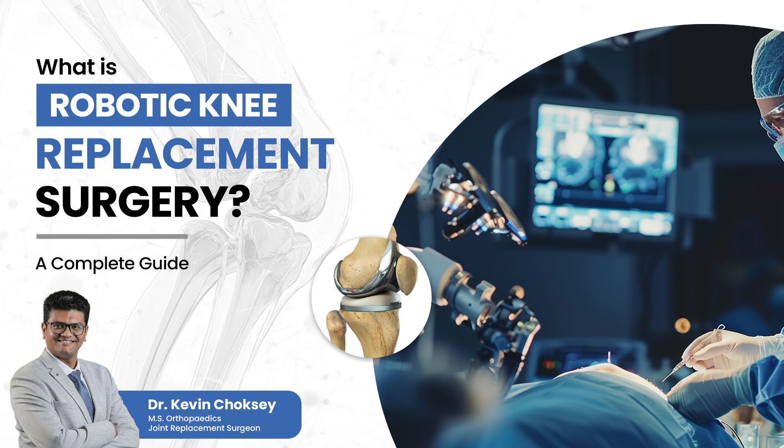 robotic-knee-replacement-surgery