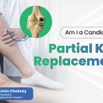 partial-knee-replacement