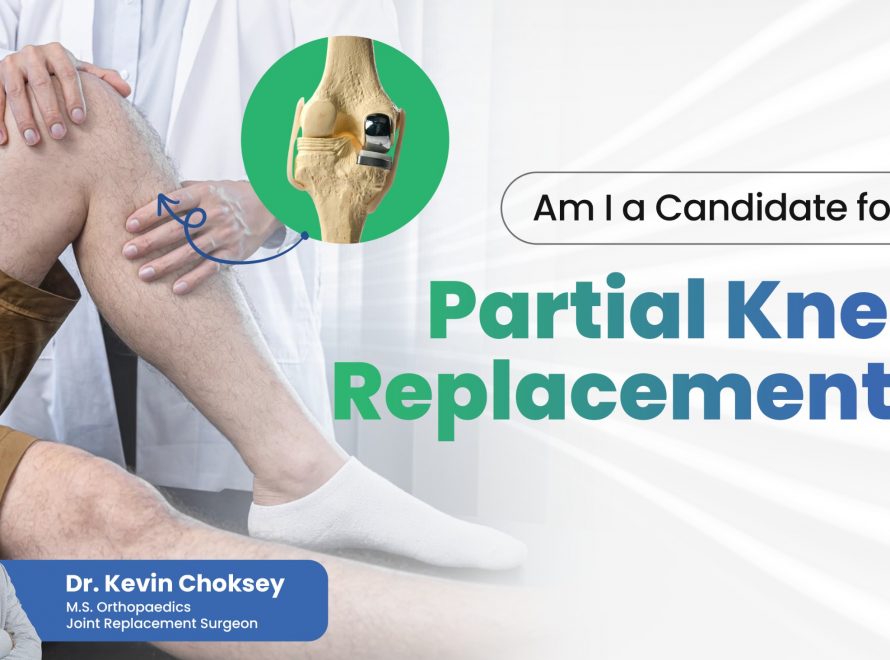 partial-knee-replacement