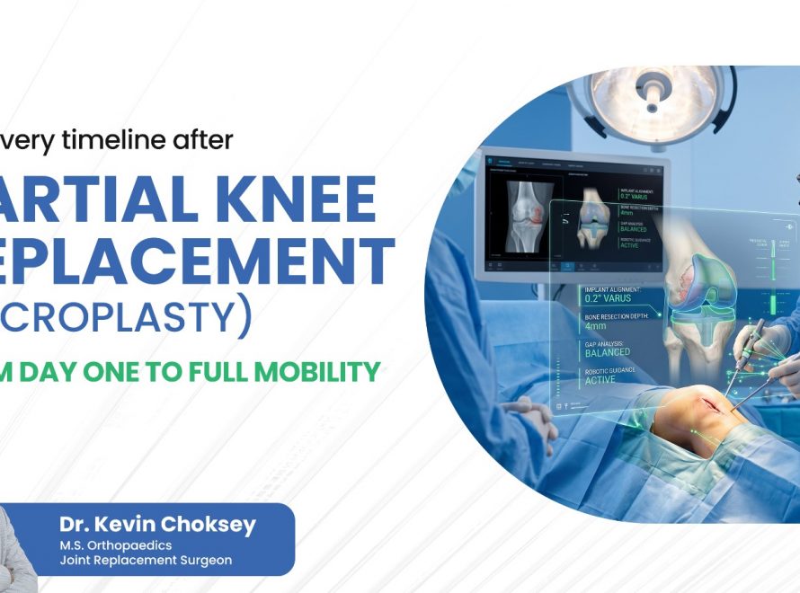 partial knee replacment