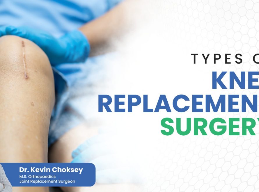 types-of-knee-replacement-surgery