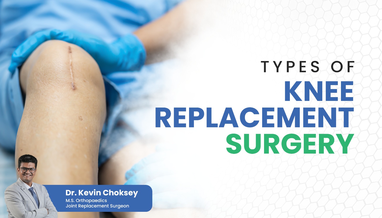 types-of-knee-replacement-surgery