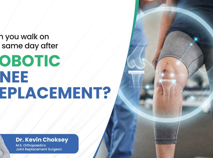 robotic-knee-replacement