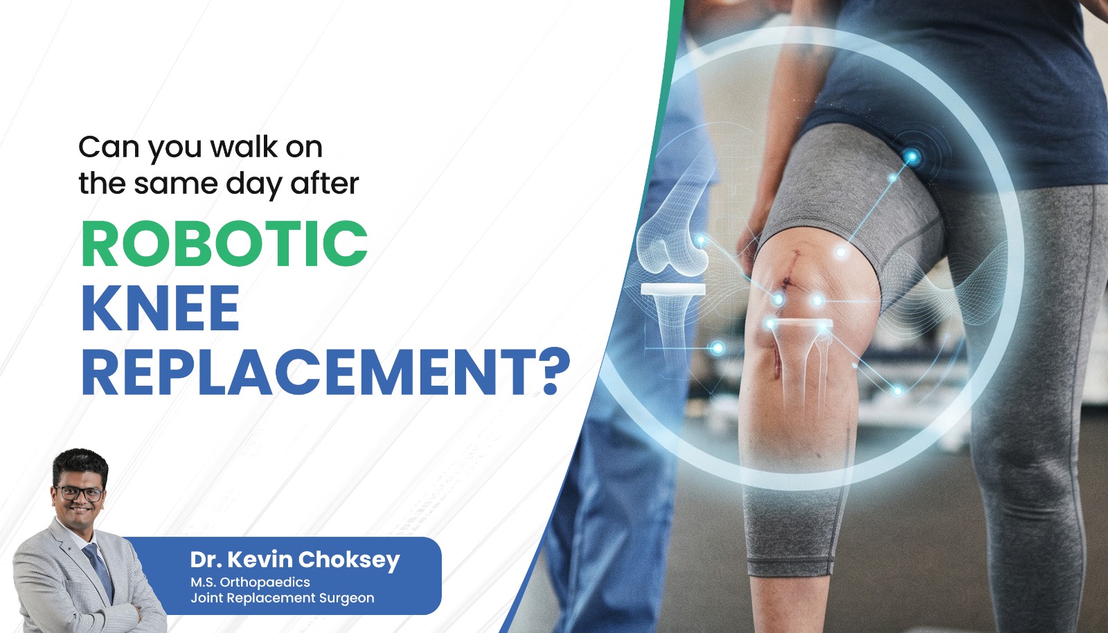 robotic-knee-replacement