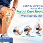 Can You Bend Your Knee Better After Partial Knee Replacement What Recovery May Look Like