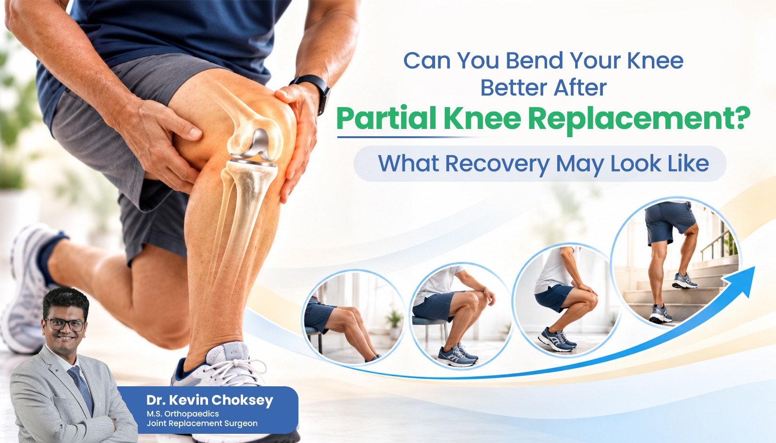 Can You Bend Your Knee Better After Partial Knee Replacement What Recovery May Look Like